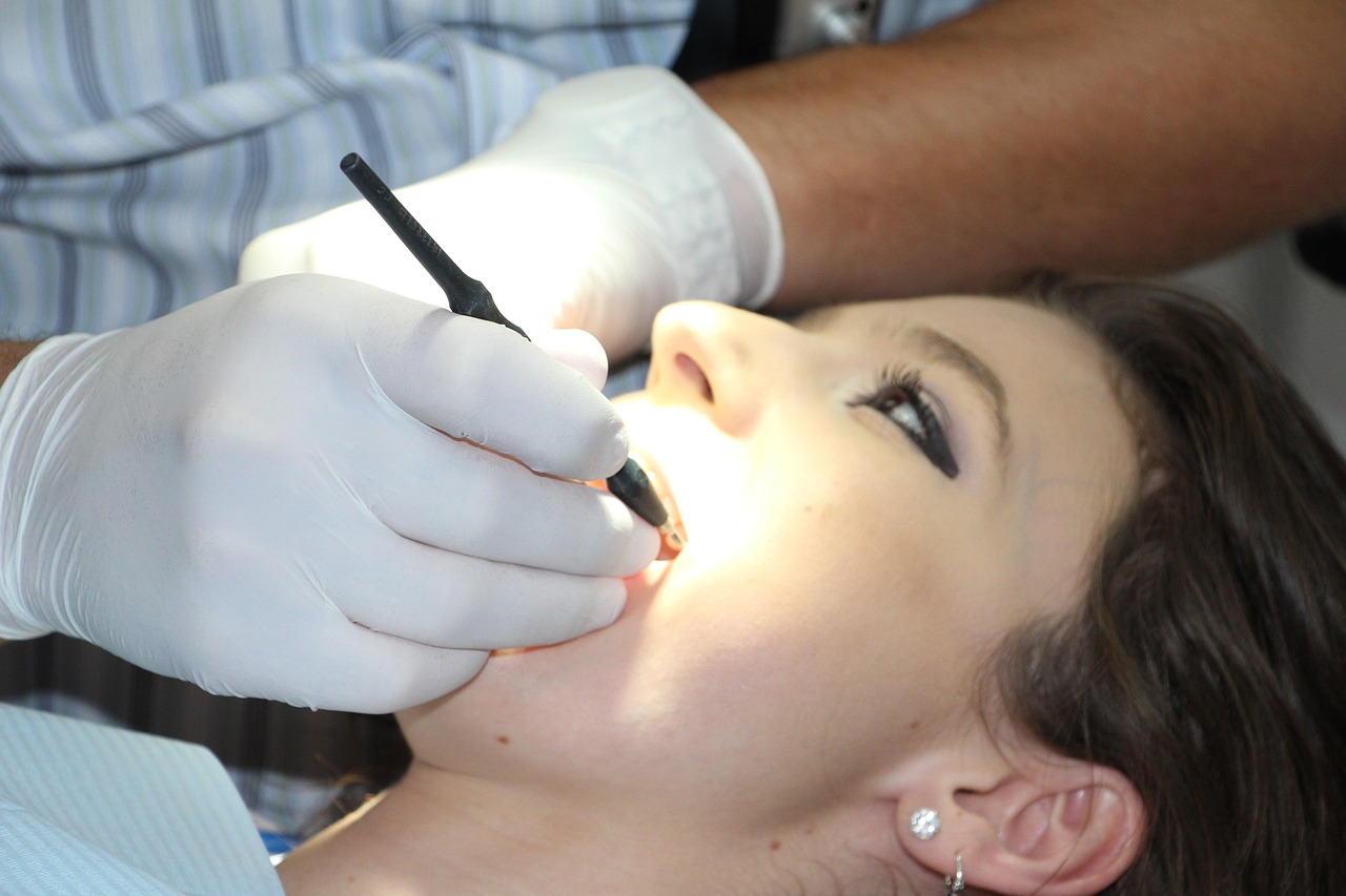 Limpieza Dental
